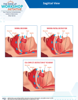 P25024 DPA Sagittal View